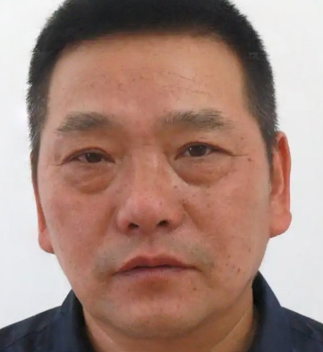 去眼袋手术
