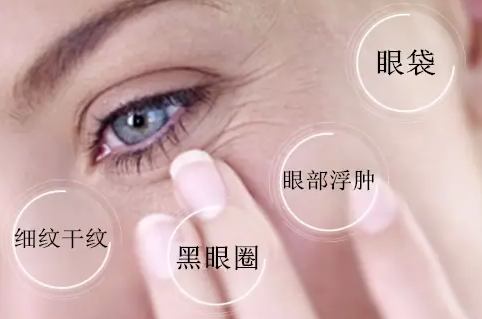 去眼袋手术