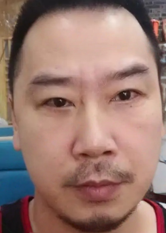 去眼袋手术