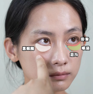 去眼袋手术