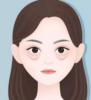 去眼袋手术