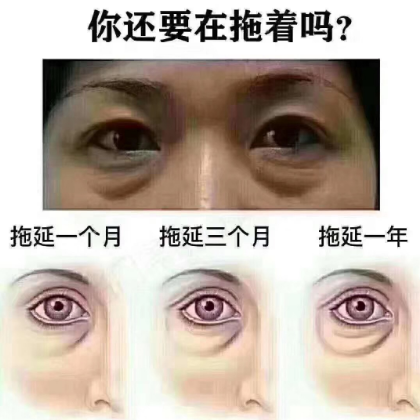 去眼袋手术