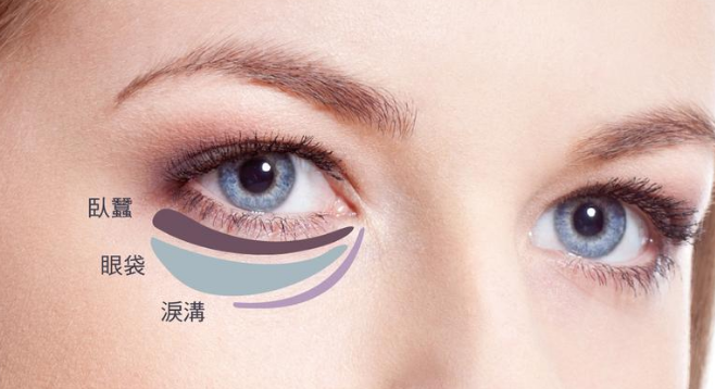 去眼袋手术