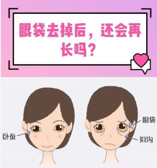 去眼袋手术