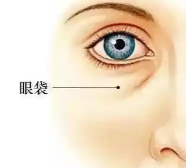 眼袋