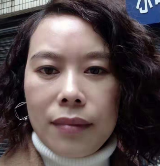 去眼袋手术