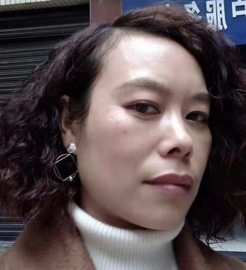 去眼袋手术