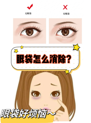 去眼袋手术