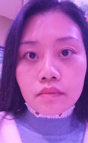 去眼袋手术