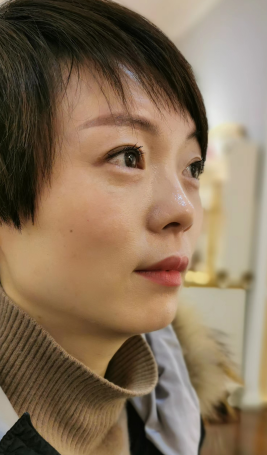 去眼袋手术