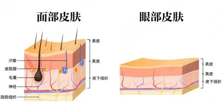 去眼袋手术