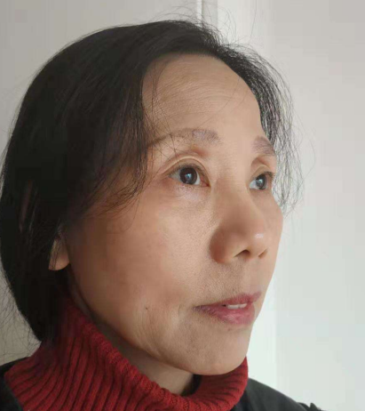 去眼袋手术
