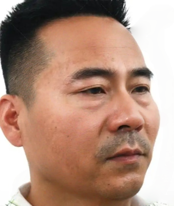 去眼袋手术