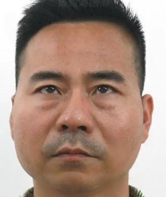 去眼袋手术