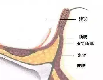 去眼袋手术