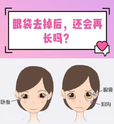 去眼袋手术