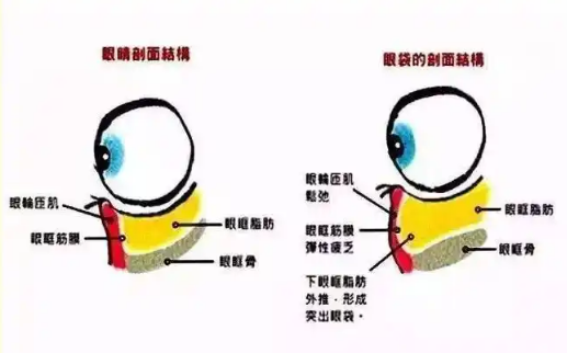 眼袋