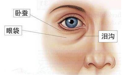 去眼袋手术