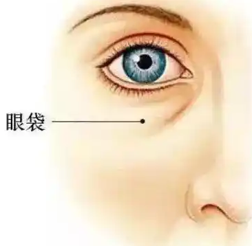 眼袋
