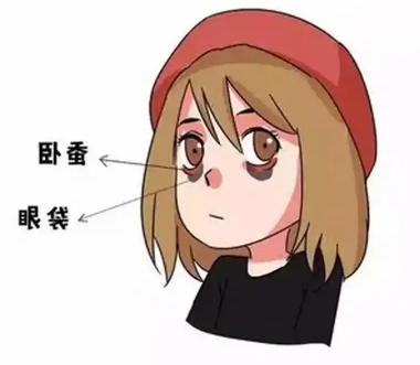 去眼袋手术