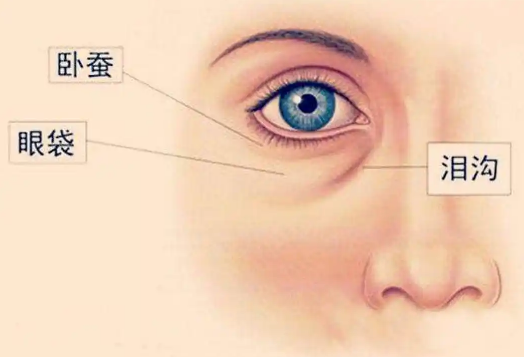 去眼袋手术