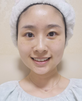 去眼袋手术
