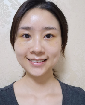 去眼袋手术