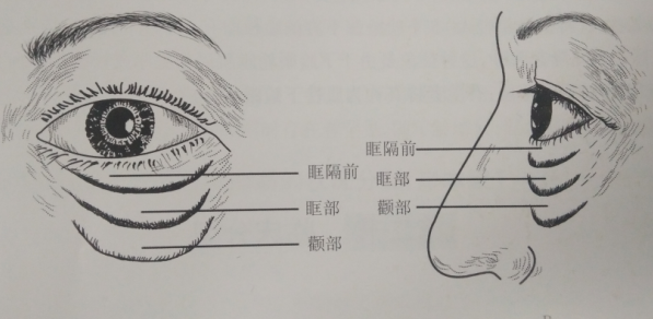 眼袋