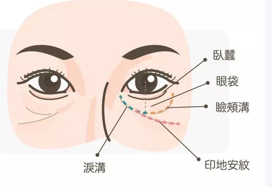 眼袋