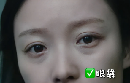 眼袋