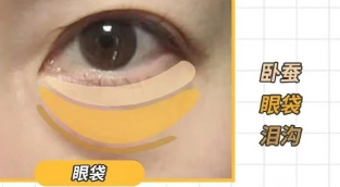 眼袋