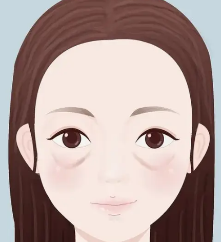 眼袋