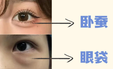 眼袋