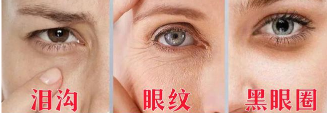 眼袋