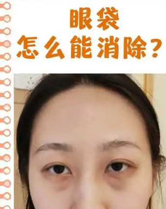 眼袋