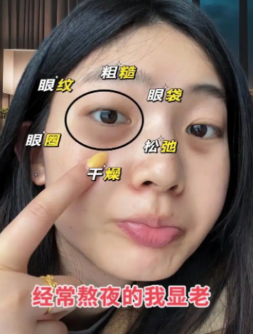 眼袋