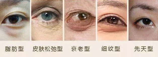 眼袋