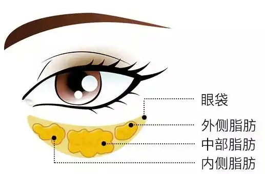 眼袋