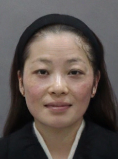 去眼袋手术