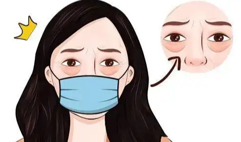 去眼袋手术