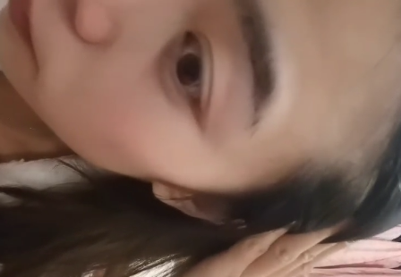 去眼袋手术