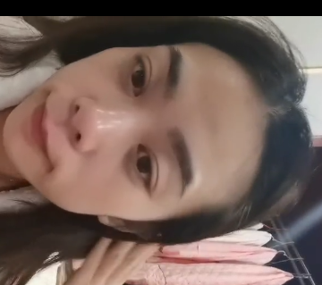 去眼袋手术