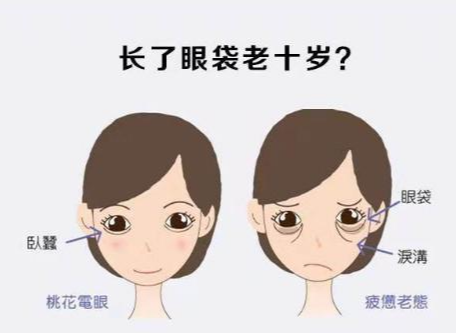 眼袋