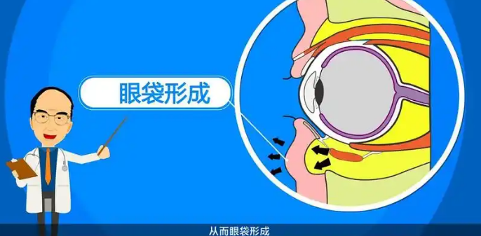 眼袋