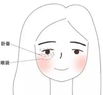 眼袋