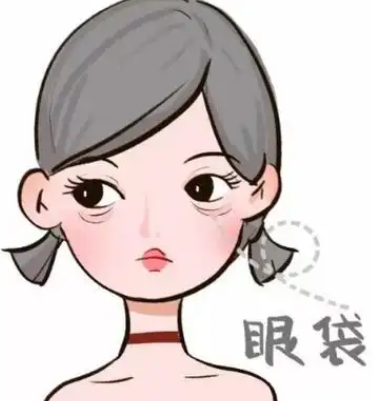 去眼袋手术