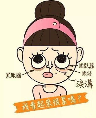 去眼袋手术