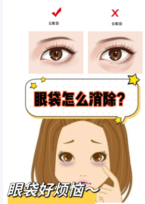 眼袋