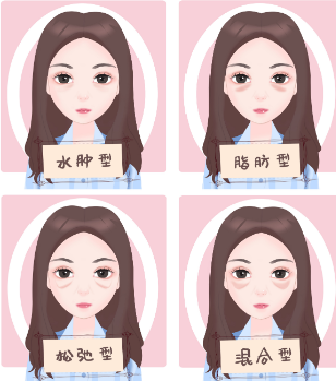 去眼袋手术
