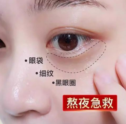 去眼袋手术